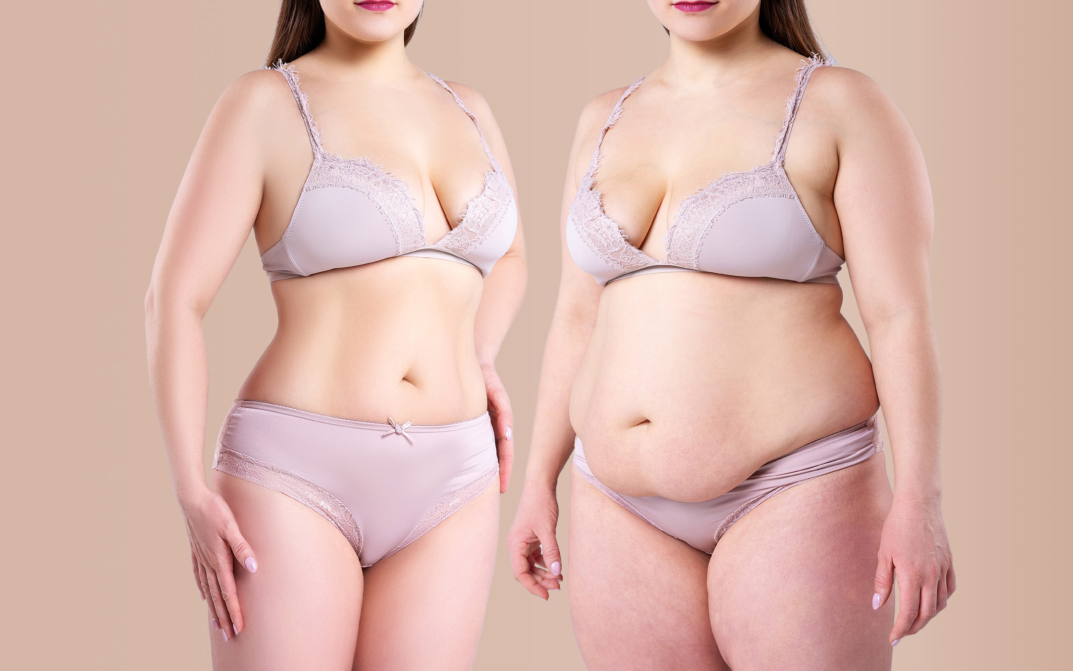 tummy tuck