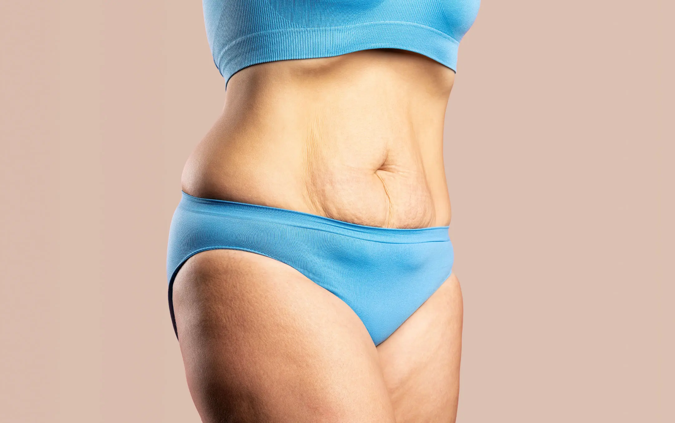 Tighten Loose Skin After Weight Loss