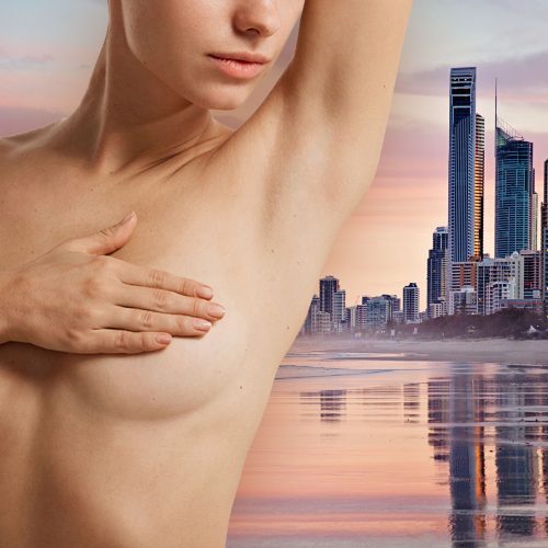 Breast Augmentation Mammaplasty On The Gold Coast