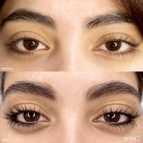 Before and after pictures of lash serum