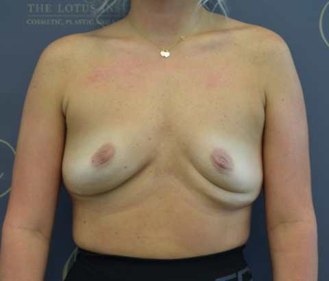 Patient 16: Before