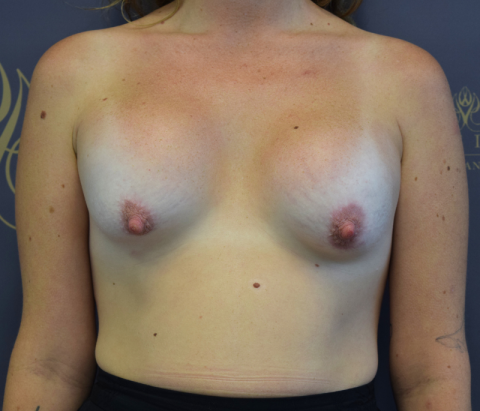 Patient 10: Before