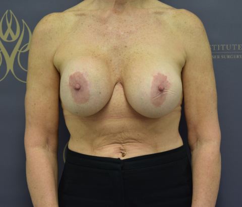 Patient 13: Before