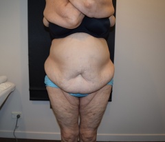 Patient 5: Before